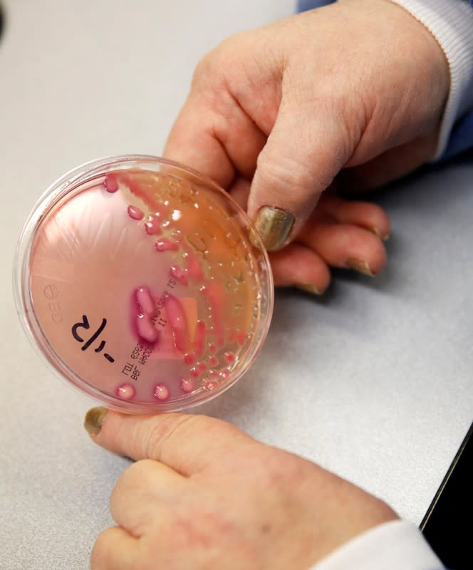 FILE PHOTO: Berkeley Medical Center Laboratory Manager Harvey displays the Klebsiella pneumonia organism in West Virginia