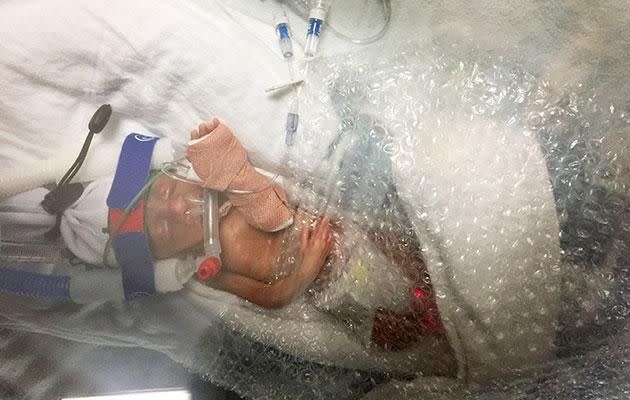 Doctors wrapped Jenson in bubble wrap to save his life. Photo: Caters News