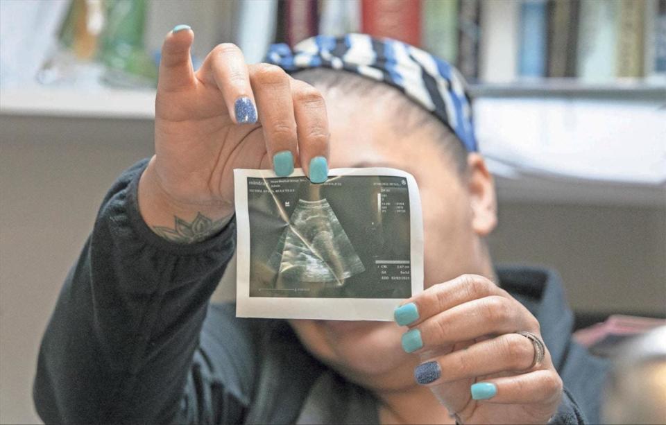 A patient seeking an abortion at Hope Medical Group for Women in Shreveport, La., holds up her ultrasound photo on Wednesday.