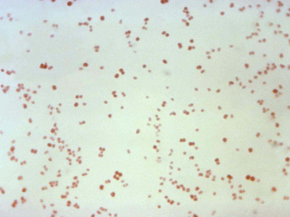 This 1971 microscope image made available by the Centers for Disease Control and Prevention shows Neisseria gonorrhoeae bacteria, which causes the sexually transmitted disease gonorrhea. (CDC via AP)