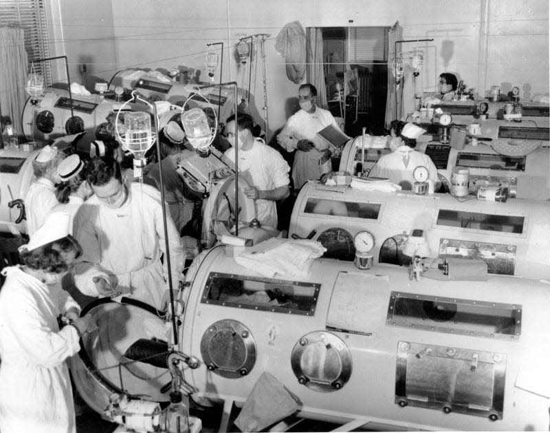 This is a scene in the emergency polio ward at Haynes Memorial Hospital in Boston, MA., on Aug. 16, 1955. The city’s polio epidemic hit a high of 480 cases. The critical patients are lined up close together in iron lung respirators so that a team of doctors and nurses can give fast emergency treatment as needed. - Photo: AP (AP)