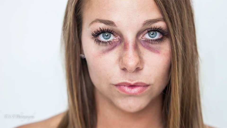 Brooke Beaton's boyfriend allegedly punched her repeatedly in the face and then choked her while she sat in the passaenger seat of his car.