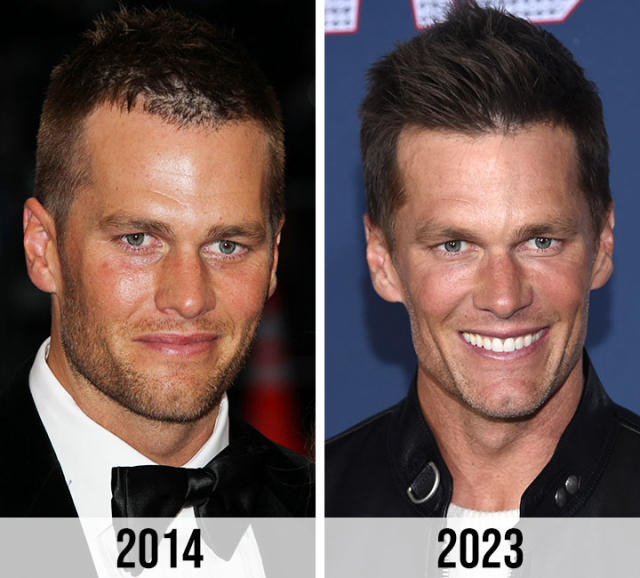 tom brady aging