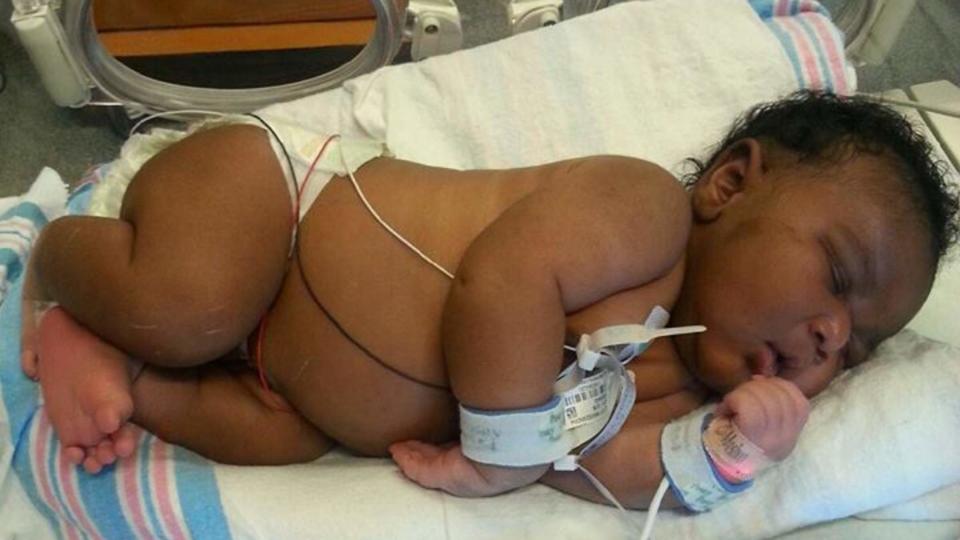 Whoa Baby! Newborn Weighs 14.1 Pounds