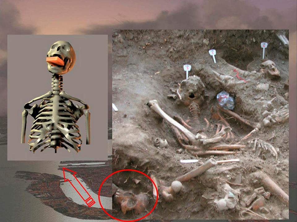 A composite picture shows a 3D reconstritution of the body holding a brick in the mouth next to a picture of the remains in situ in a mass grave