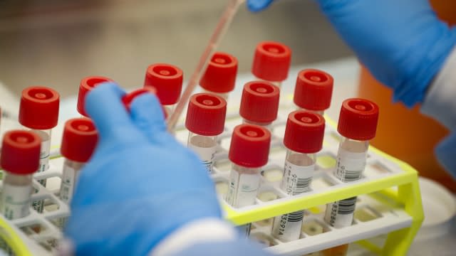 A technician prepares COVID-19 coronavirus patient samples for testing at a laboratory.