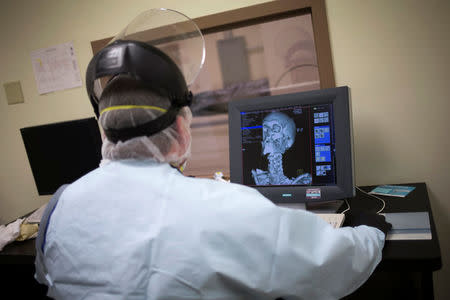 A man studies a CAT scan as the body of a suspected opioid overdose lies in the background at ForensicDx, a company which specializes in autopsies and scientific testing, in Windber, Pennsylvania, U.S. on August 9, 2017. REUTERS/Adrees Latif