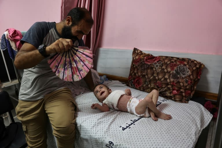 La bebé palestina Wateen al Adasi, que contrajo una enfermedad cutánea debido a la desnutrición, en el hospital Kamal Adwan en Beit Lahia, en el norte de la Franja de Gaza, el 2 de julio de 2024 (Omar AL-QATTAA)