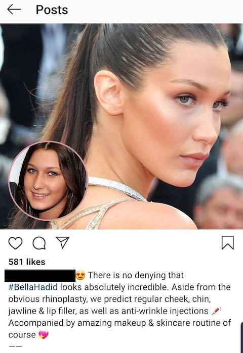 Some accounts include speculation around treatments a celebrity may have received  - Credit: Instagram