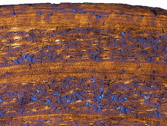 Two large, light and blood vessel ridden areas of bone growth are seen here in the bone of a 14-year-old Alpine red deer. They are intersperced with small, dark lines called rest lines.