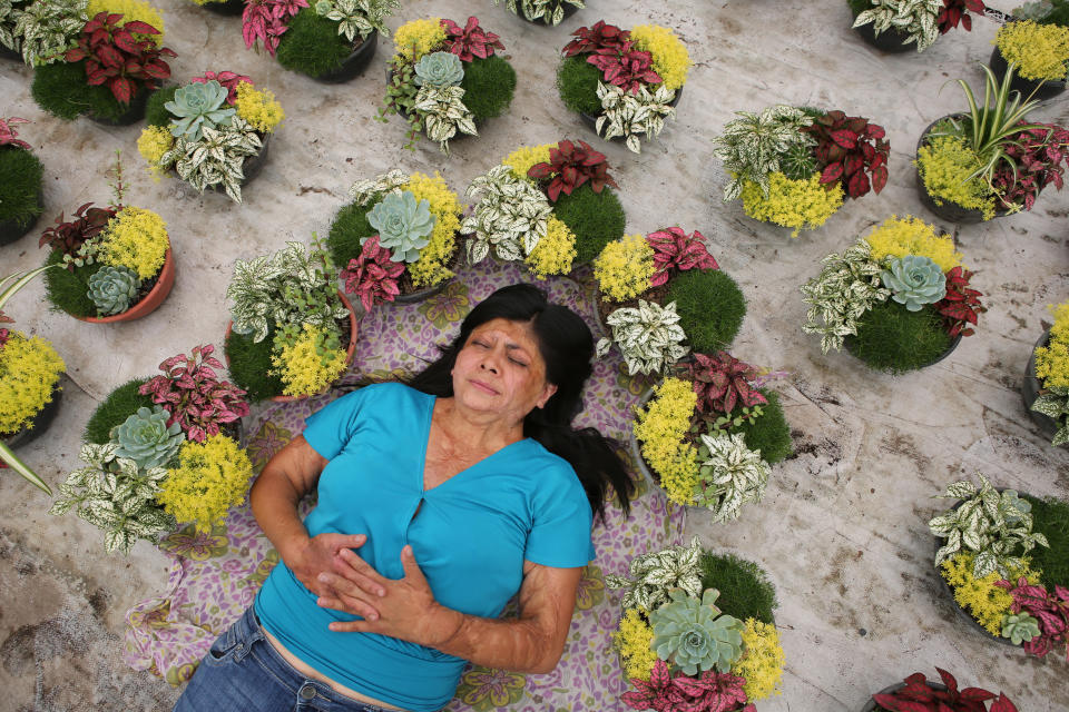 Elisa Xolalpa, who survived an acid attack when tied to a post by her ex-partner 20 years ago when she was 18, poses for a portrait inside her greenhouse where she grows flowers to sell at a market in Mexico City, Sunday, May 30, 2021. “I have to turn this pain into something else,” Xolalpa said. For now, that means demanding justice and not being silent. (AP Photo/Ginnette Riquelme)