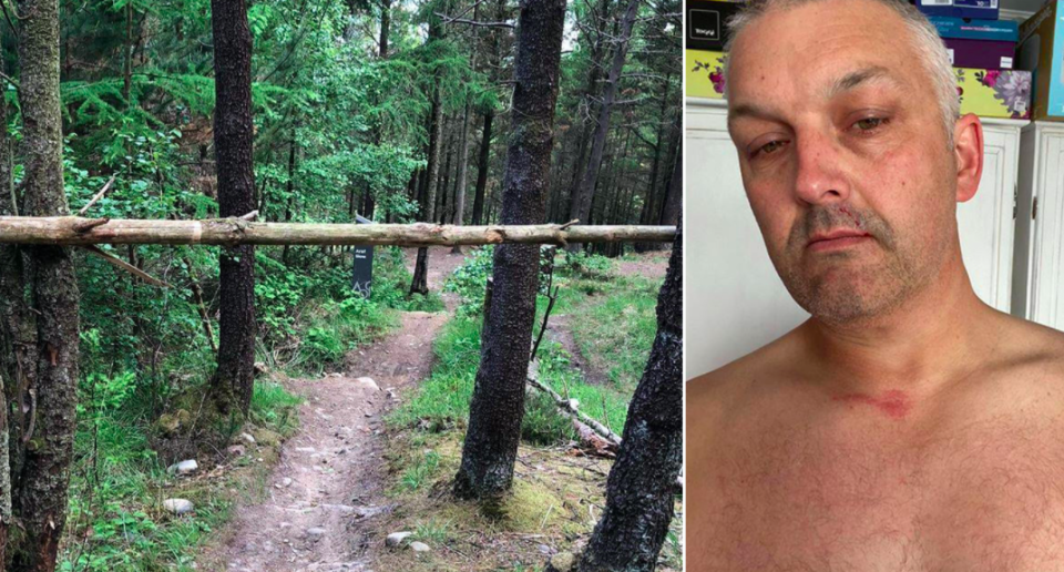 Neil Nunnerley was injured after hitting a barrier stretched across a cycling trail in Wales. (Wales News)