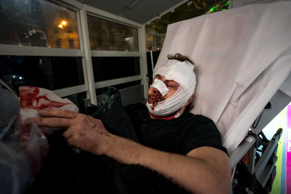 Le photographe syrien indépendant Ameer al Halbi, 24 ans couvrait la manifestation place de la Bastille samedi 28 novembre 2020 - Gabrielle Cézard -  AFP