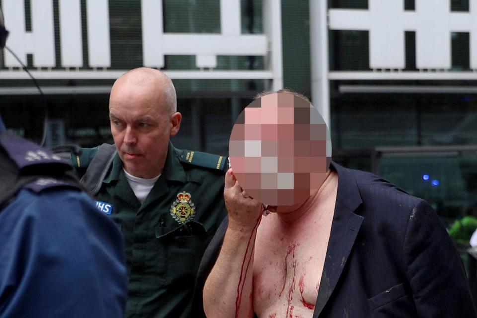 A Government worker was raced to hospital after the attack last week (Reuters/Simon Dawson)