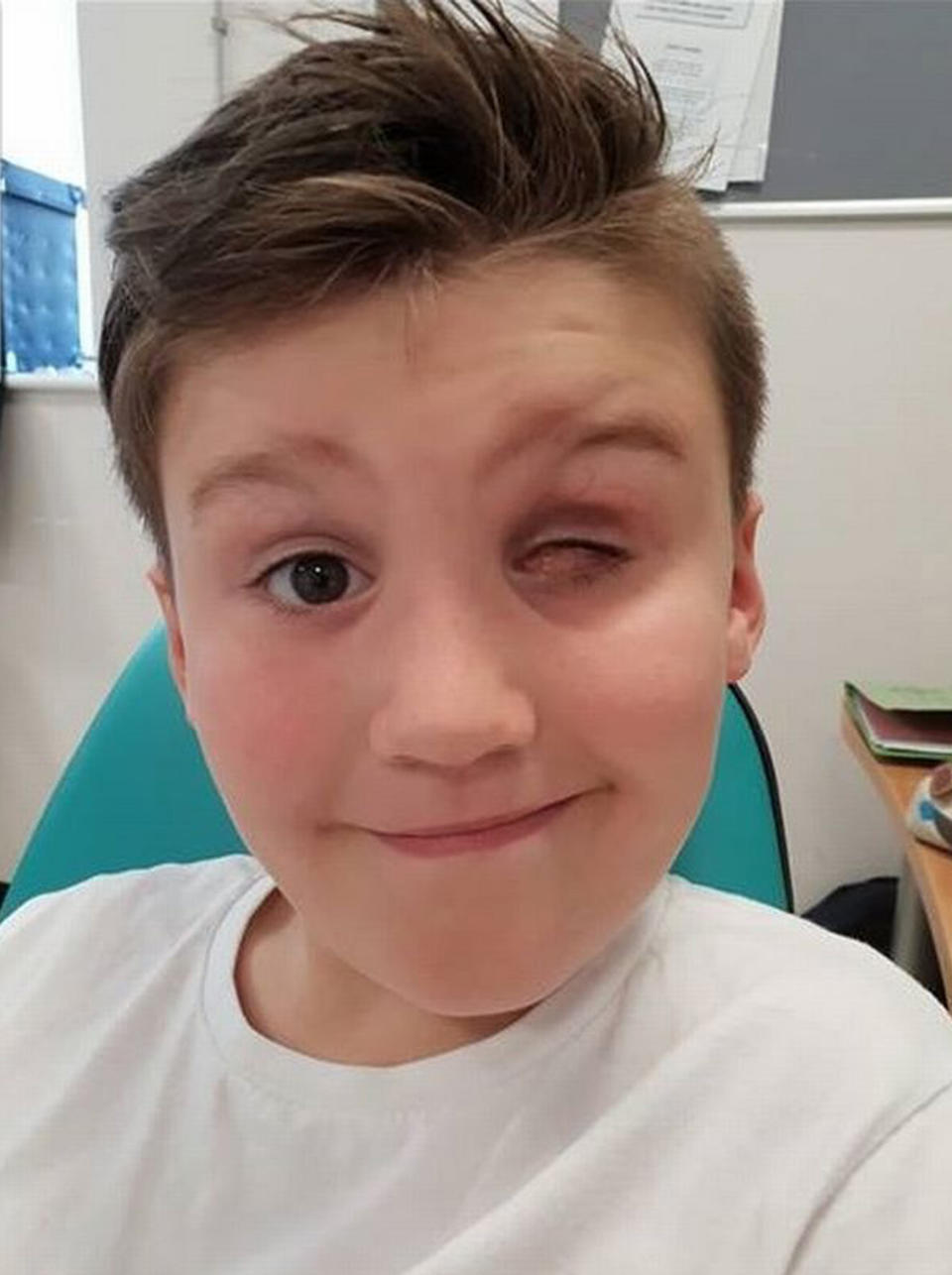 Nerf gun accident: Taylor-Jay Ravicini, 9, (pictured) from Swansea, South Wales lost is eye after a Nerf gun accident.