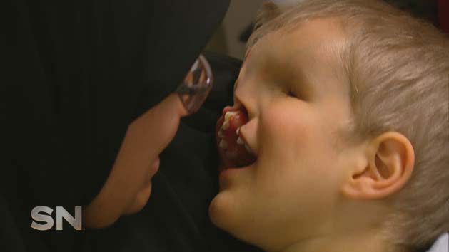 Yahya before his surgery with his mother in Morocco