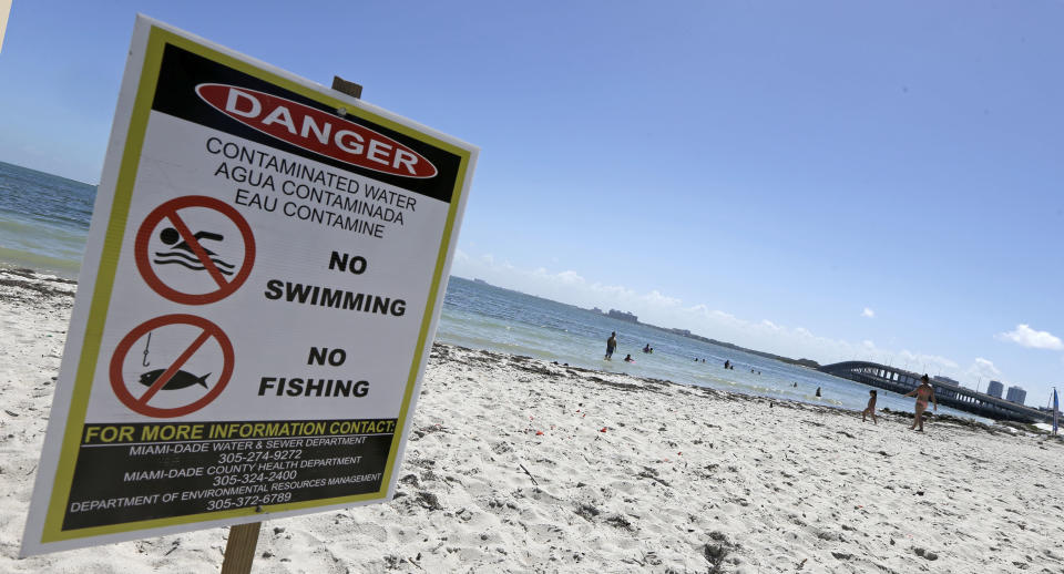 A swimming advisory posted at Miami's Hobie Beach in July 2016.&nbsp; (Photo: ASSOCIATED PRESS)