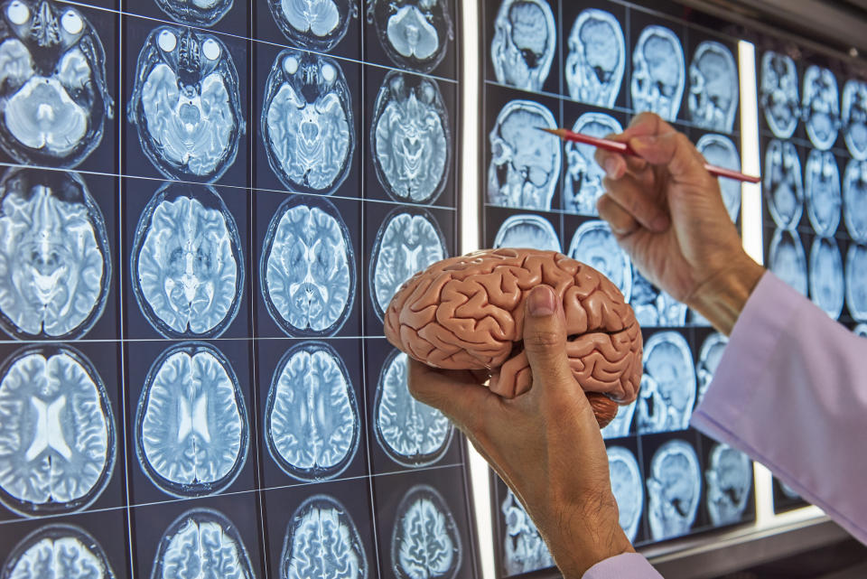 What's it like to be a neurosurgeon? Source: Getty