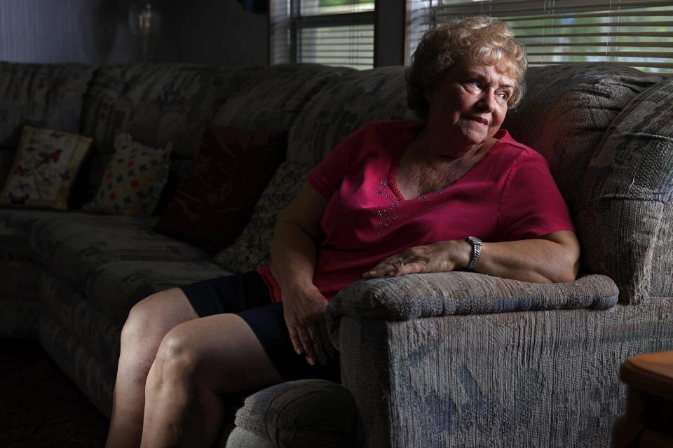 Ana Harrell, 77, is shown in portrait at her home March 24, 2022 in Jacksonville. She's suing Dr. Richard David Heekin after a total right knee replacement surgery. Heekin and the hospital have denied the claims. The lawsuit is ongoing in court.