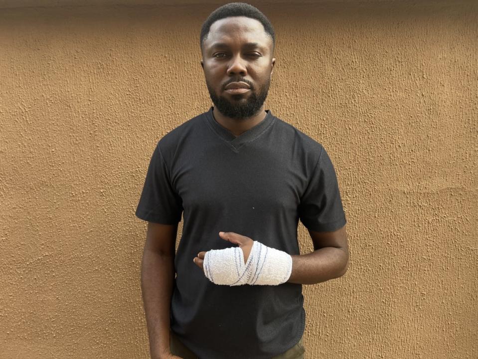 Philip Obaji Jr. with a bandaged hand and swollen eye after receiving treatment.