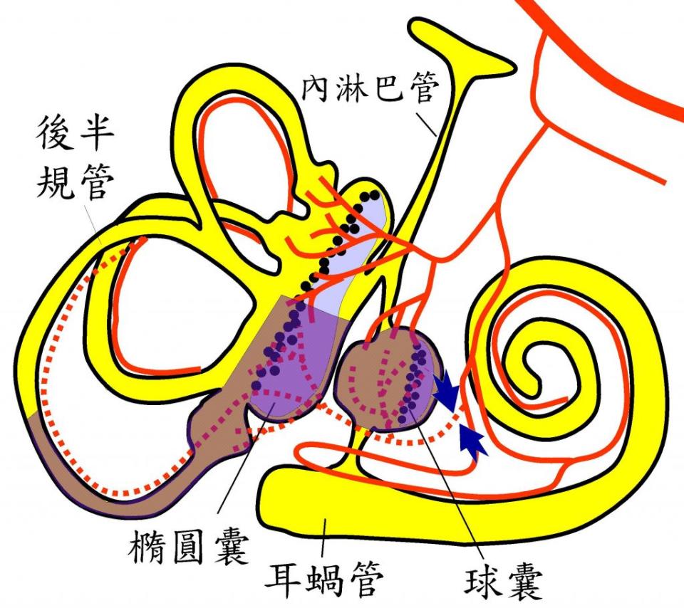 醫師陳建志說明，後方前庭動脈缺血（紅色虛線條為缺血；藍色箭頭為狹窄或阻塞處）會影響到球囊、橢圓囊及後半規管 （紫色區）。 （醫師陳建志提供）