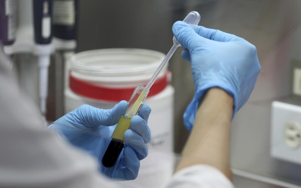 An employe of a genetic institute prepares a DNA sample in Bogota, Colombia, Thursday, Nov. 14, 2019. The genetic institute through DNA tests was able to verify that two women who were given up for adoption one in Spain and other in Colombia, after the Nevado del Ruiz erupted in 1985, are sisters. (AP Photo/Fernando Vergara)