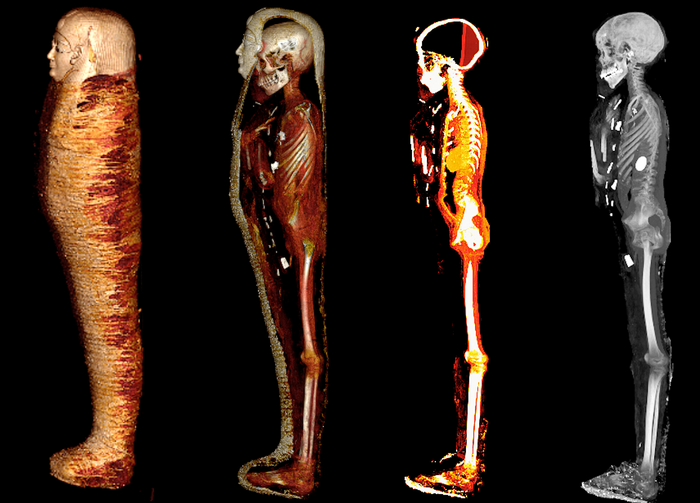 The scans revealed the amulets all over the body (Frontiers in Medicine) 