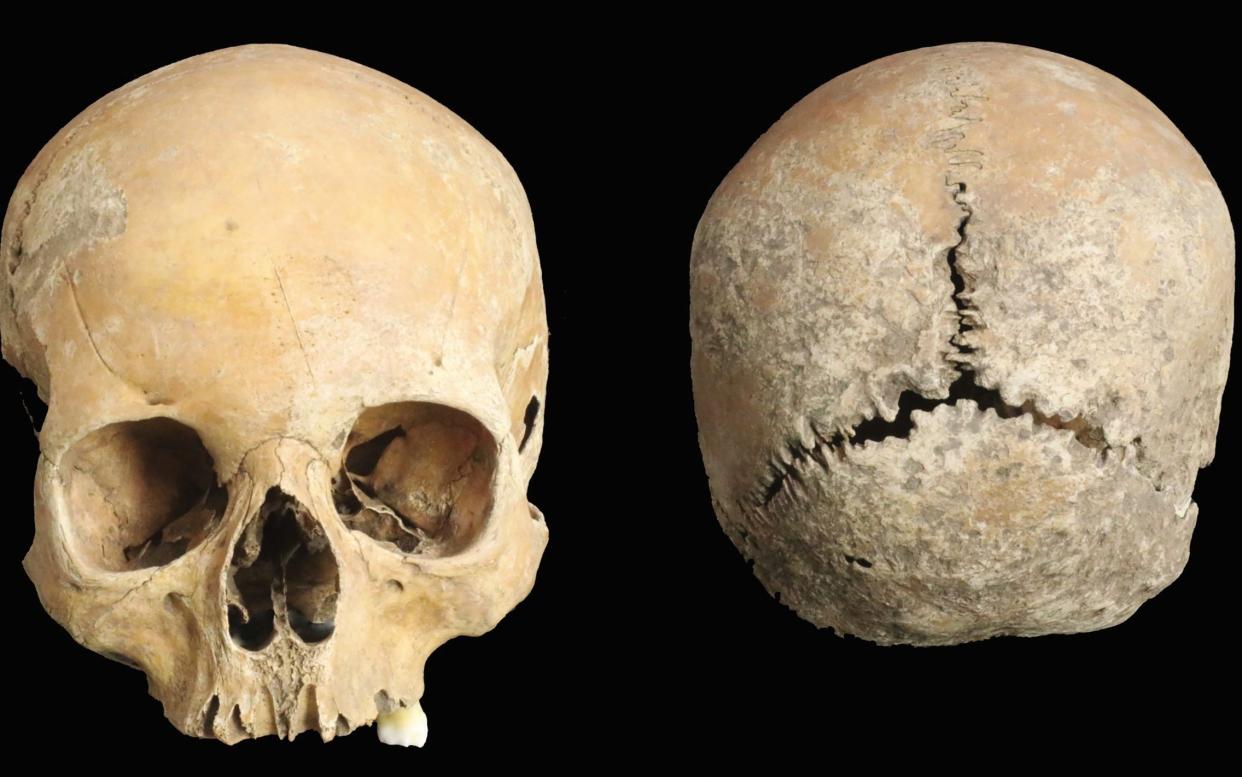 The girl's skull, which was found in a spoil heap produced during the excavation of a burial site - Antiquity/Antiquity