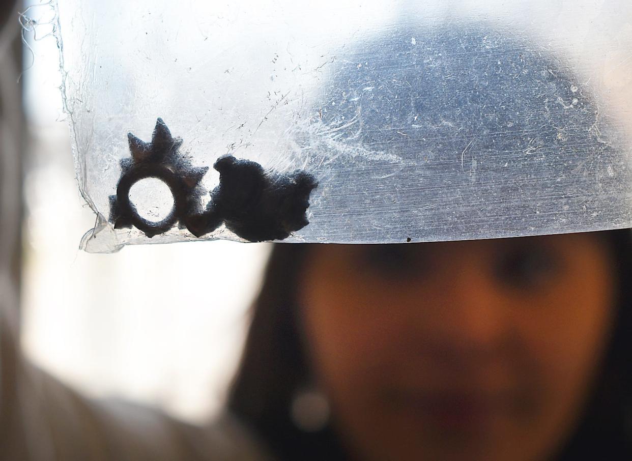 Linoshka Acevedo hold's the bullet that was removed from Honey.