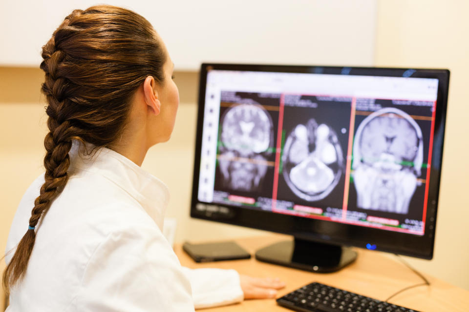 Female doctor studying an MRI scan of the brain on the computer.