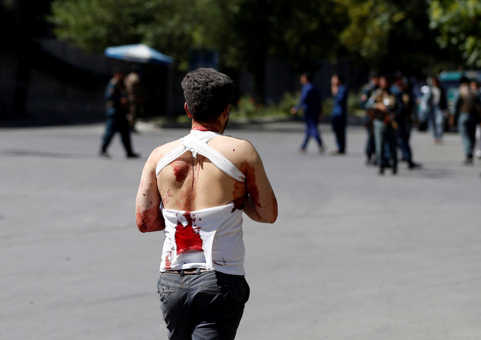 <p>An Injured Afghan man walks on the street near a hospital after a blast in Kabul, Afghanistan May 31, 2017. (Omar Sobhani/Reuters) </p>