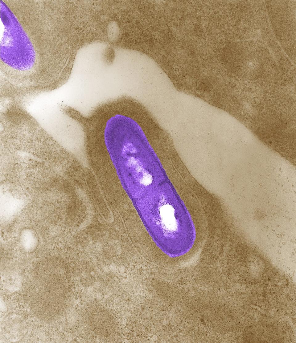An electron micrograph of a Listeria bacterium in tissue is seen in a 2002 image from the Centers for Disease Control and Prevention (CDC).