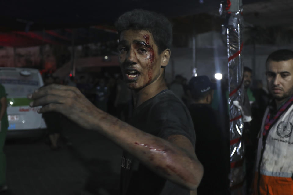 An injured Palestinian man arrives at the al Shifa hospital following Israeli airstrikes on Gaza City, Tuesday, Oct. 24, 2023. (AP Photo/Abed Khaled)