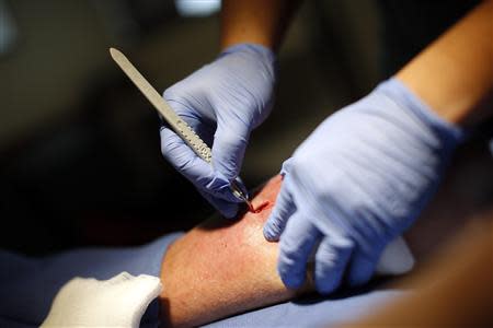 Doctor Andy Chiou debrides a leg wound on patient Larry Kirk in Peoria, Illinois, November 26, 2013. REUTERS/Jim Young