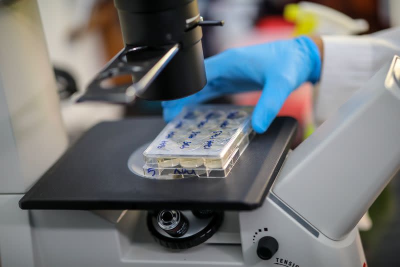 Scientist holds cells that produce antibodies against the coronavirus disease (COVID-19) under a microscope, in a university lab in Athens