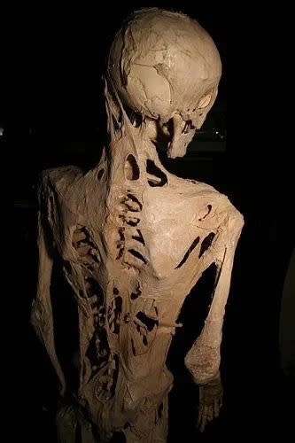 A decomposed and skeletal human figure, viewed from behind, showing intricate bone details and decayed tissue remnants