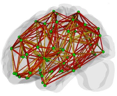 Fig.3: How should a model brain be connected? (Source: Li et al. 2009, PLoS Comp. Biol. 5(5):e1000395)