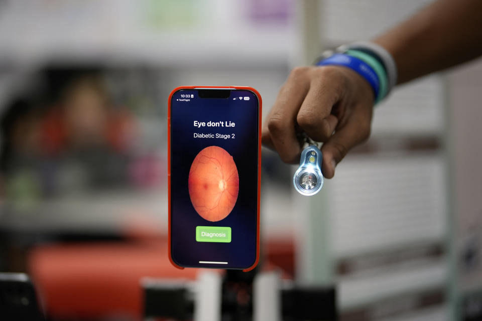 Eighth grader Anik Sahai, 14, displays an app he created that uses a cellphone's camera to diagnose diabetic retinopathy, an eye disease that is a leading cause of blindness worldwide, in the Science Fair class at A.D. Henderson School in Boca Raton, Fla., Tuesday, April 16, 2024. Sahai's app took first place in the state's middle school science fair and is being considered for commercial use. (AP Photo/Rebecca Blackwell)