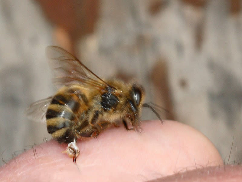 The barbed stinger of a honey bee is torn off and remains in the skin: Wikipedia commons