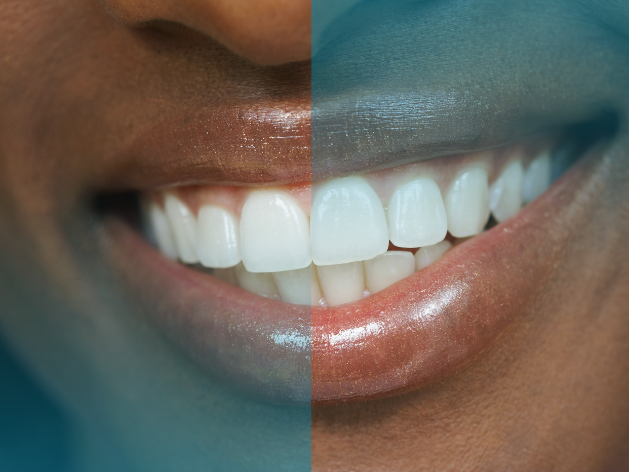 closeup of a woman's toothy grin