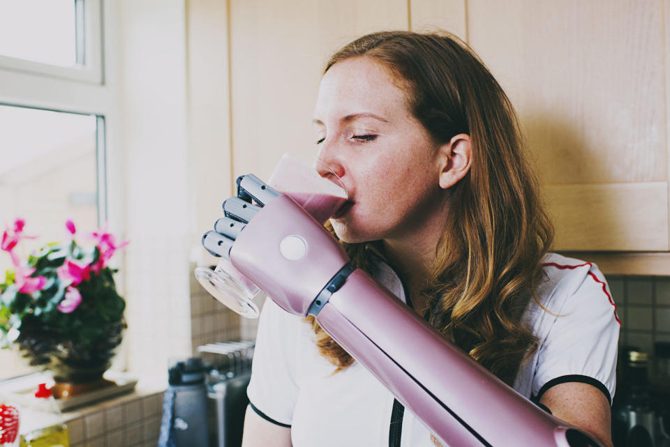 Open Bionics announced today that its 3D-printed Hero Arm prosthetic will be