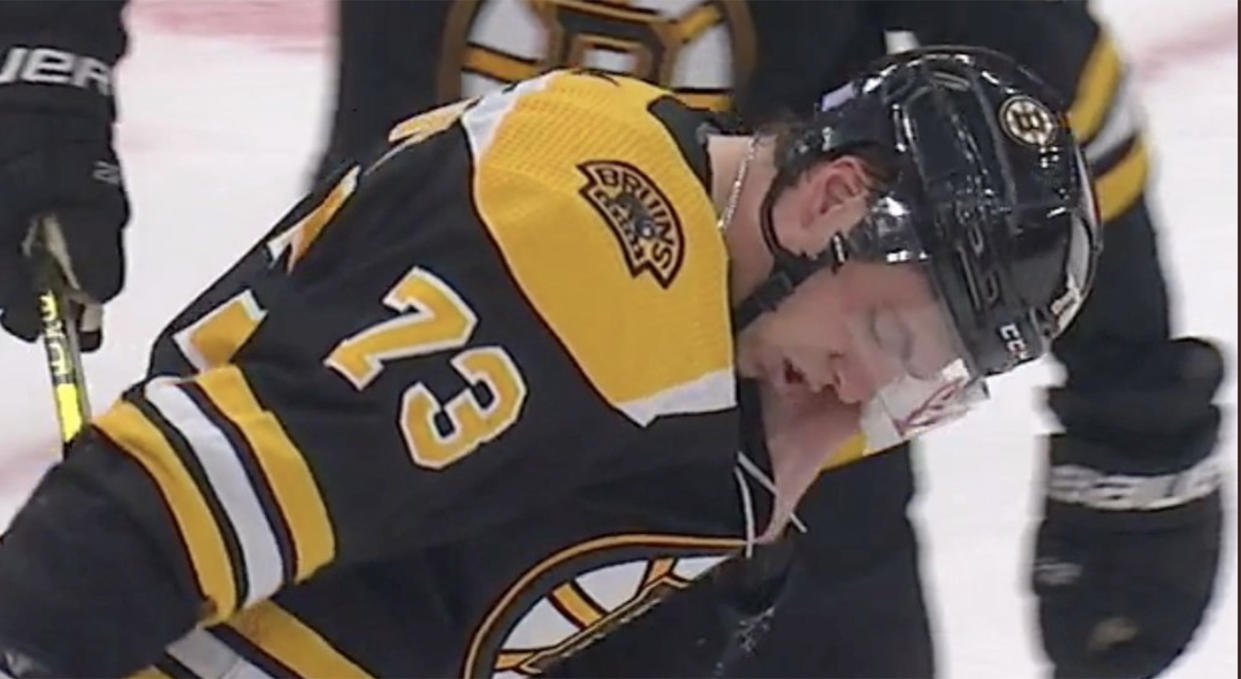 Bruins' Charlie McAvoy injured hitting head on post