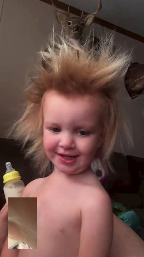 Phoebe has a condition called Uncombable Hair Syndrome [Photo: SWNS]