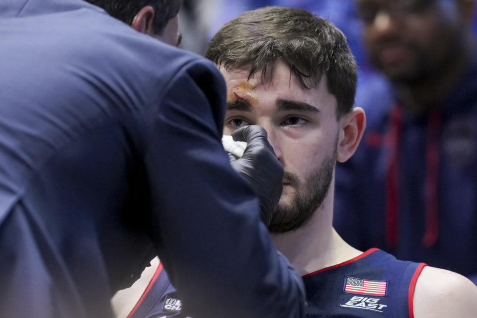 UConn forward Alex Karaban sits on the bench as he is tended to for an injury, by associate head athletic trainer James Doran during the second half of the team's NCAA college basketball game against Xavier, Wednesday, Jan. 10, 2024, in Cincinnati. (AP Photo/Aaron Doster)