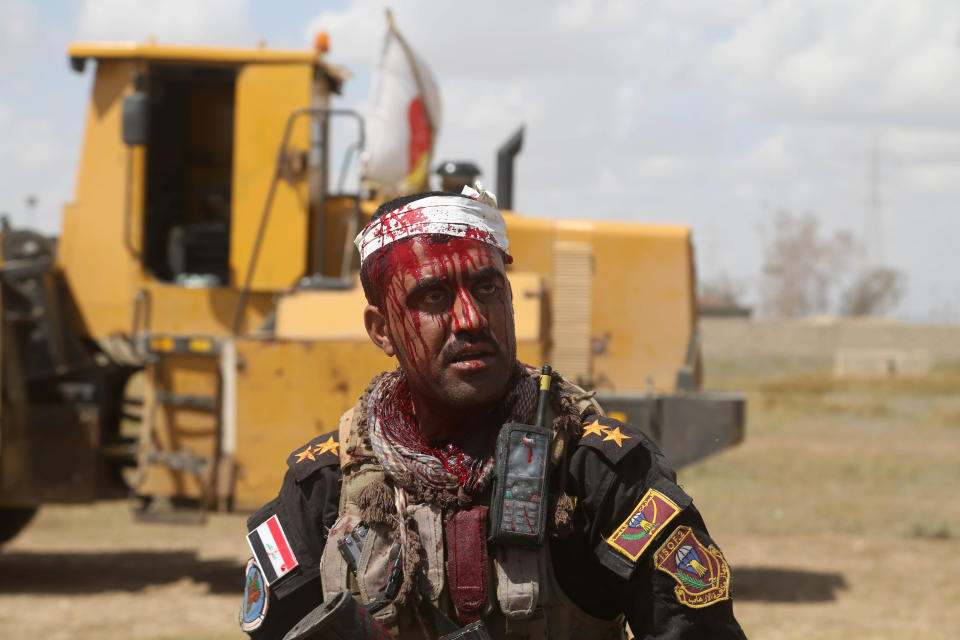 This Monday, March 30, 2015 file photo shows an injured Iraqi officer waiting for treatment on the front line during clashes with Islamic State extremists in Tikrit, 80 miles north of Baghdad, Iraq. (AP Photo/Khalid Mohammed, File)