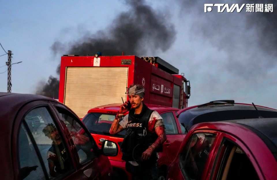 先前才傳以色列空襲黎巴嫩，造成記者1死6傷，圖為受傷的法新社攝影師。（圖／AP美聯社）