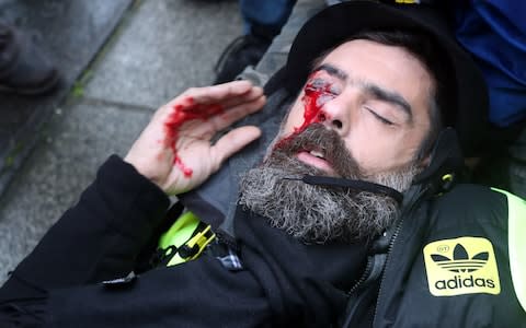 Jerome Rodrigues, one of the leaders of the "Yellow Vest" (Gilets Jaunes) movement, lies on the street after getting wounded in the eye during clashes with riot police in Paris - Credit: ZAKARIA ABDELKAFI/AFP