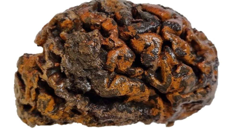 Shown here is a 1,000-year-old human brain excavated from c.  Sint-Maartenskerk cemetery, from the 10th century, in Ypres, Belgium.  The folds of the tissue, still soft and wet, are stained orange with iron oxides.  - Alexandra L. Morton-Hayward