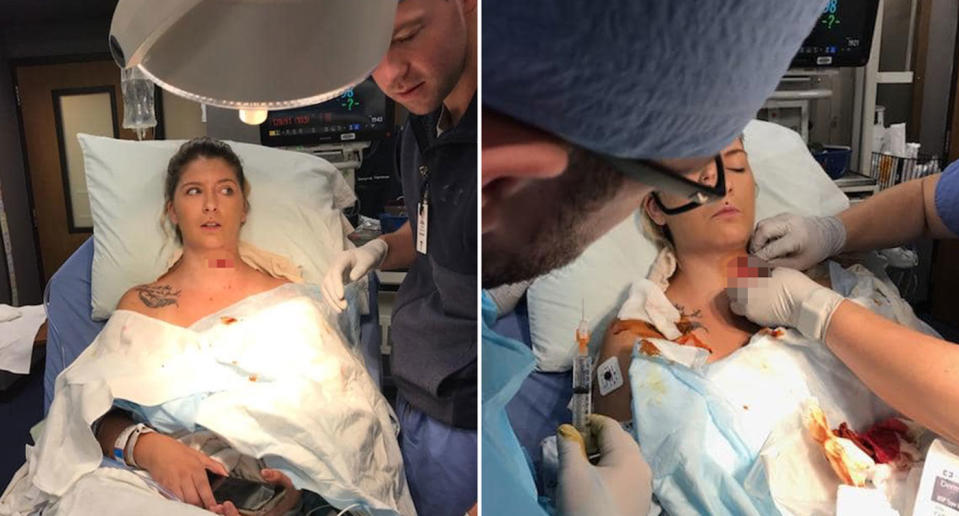 Kendra Jensen pictured in a hospital bed with a deep sliced wound to her neck. Her husband was mowing the lawn when something flew at her slicing her neck and shoulder open.