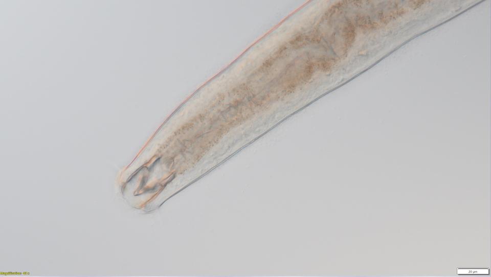 Microscopic image of a metoncholaimus nematode.